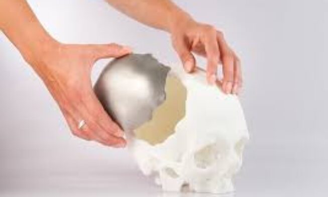 3D Printing Medical Device Market 2021 | Industry Demand, Fastest Growth, Opportunities Analysis and Forecast To 2027 img