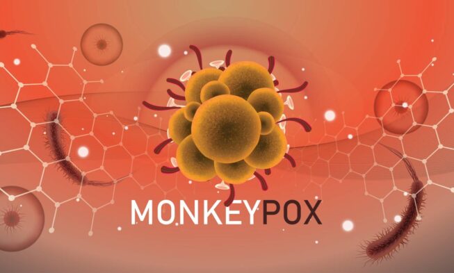 Monkeypox Outbreak: Staying Informed and Prepared img